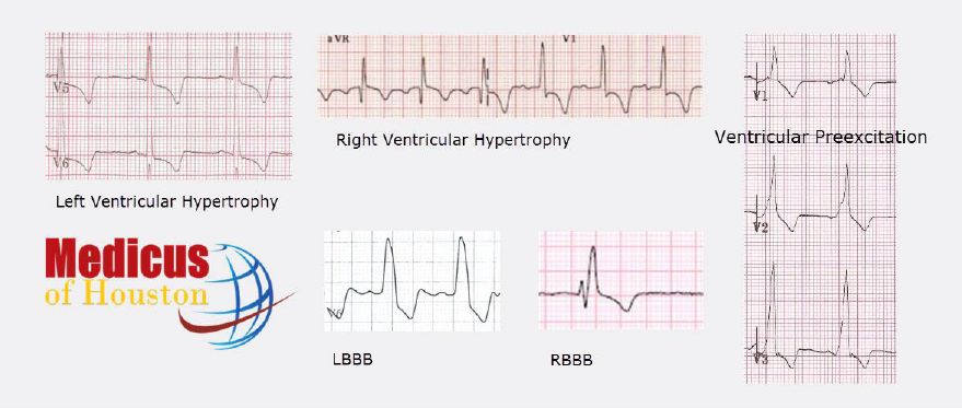 Ecg Guru Instructor Resources A Gathering Place For Instructors Of Ecg And Cardiac Topics